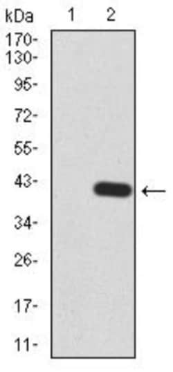 Lysine (K)-specific Demethylase 5B/KDM5B/JARID1B Antibody (7H3D7) - BSA